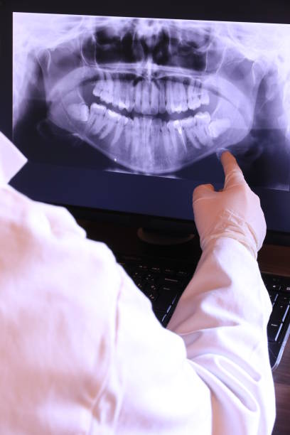 Best Emergency Treatment for Dental Infections or Abscesses in Seven Hills, OH