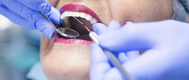 Best Emergency Dental Care for Broken or Chipped Teeth in Seven Hills, OH